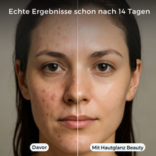 Lade das Bild in den Galerie-Viewer, Hautglanz Beauty Duschkopf - sichtbar schönere Haut